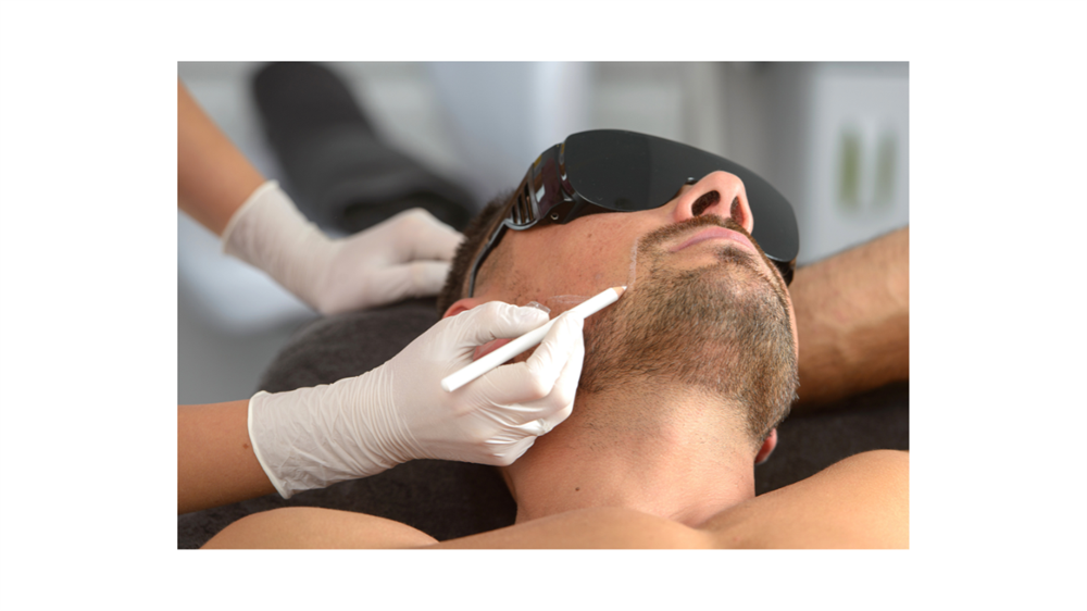 Men's Laser Hair Removal
Photo